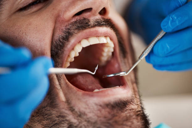 Best Invisalign and Clear Aligners  in Mannford, OK